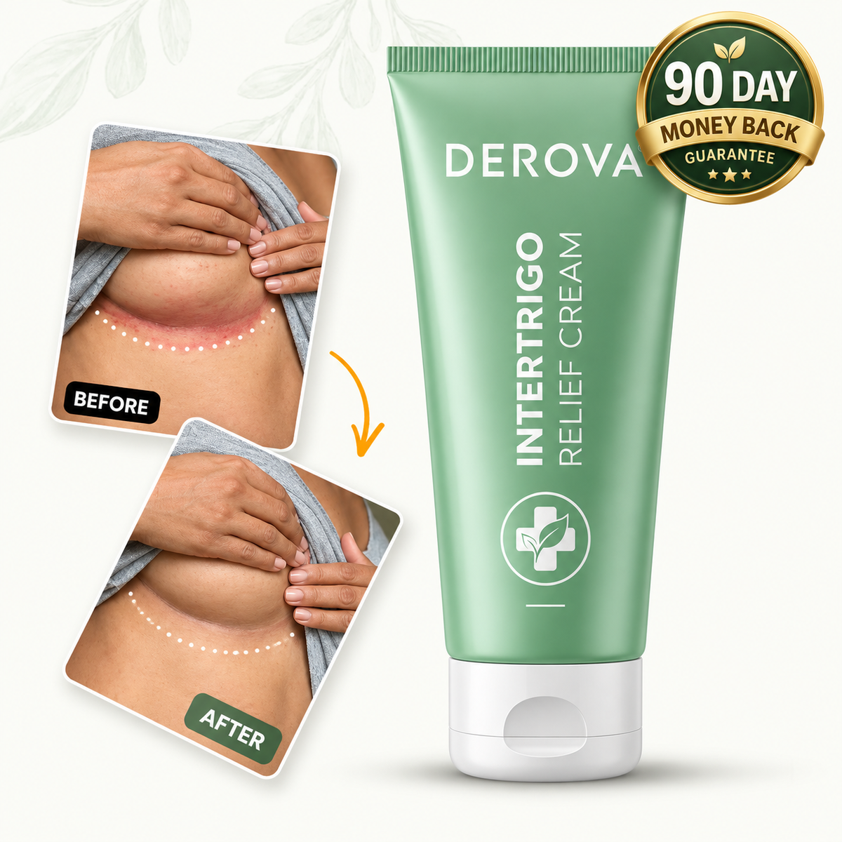 Derova™ Intertrigo Relief Cream